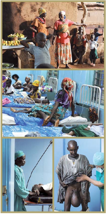 Abseits der großen Städte im Norden Ghanas liegt Nalerigu. Es mangelt an Ärzten, mit der Folge, dass sich Beschwerden enorm verschlimmern können. Fotos: Marion Koell